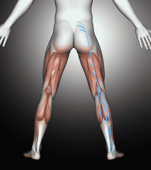 Grafik vom Ischiasnerv im menschlichen Körper